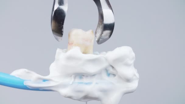 Vídeo de la extracción de dientes falsos con fórceps dentales del cepillo de dientes — Vídeo de stock