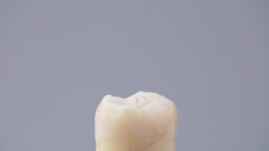 Diş kıskacıyla sahte yirmilik dişi çekmek.