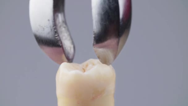 Prise de vue de faux enlever la dent avec des pinces en métal dentaire — Video