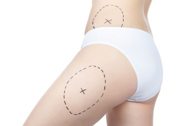 Sorun bölgeleri ile vücudun fotoğraf