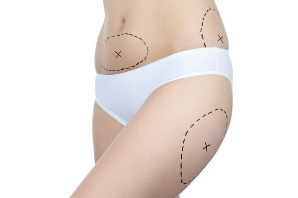 Sorun bölgeleri ile kadın fotoğrafı