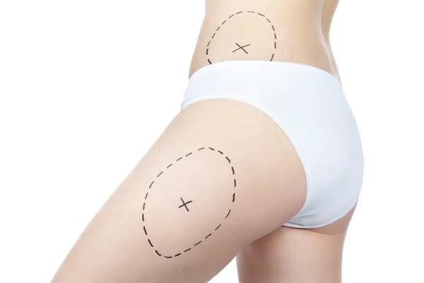 Sorun bölgeleri ile vücudun fotoğraf