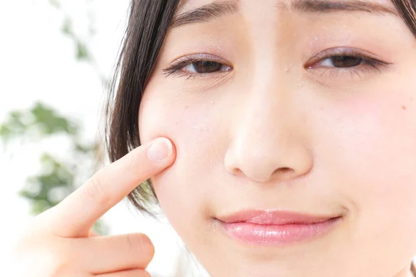 Junge Frau Kümmert Sich Hautprobleme — Stockfoto