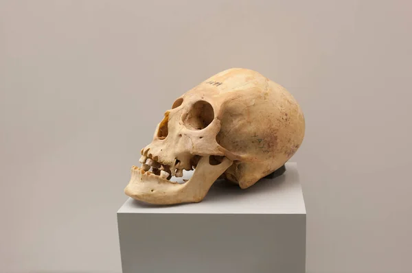 Madrid Spain July 11Th 2020 Elongated Skull Естетична Вимога Стародавніх — стокове фото