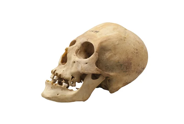 Elongated Skull Aesthetic Requirement Ancient American Peoples Chille 2Nd Century — Stock Photo, Image