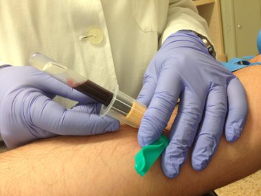 Hastanın kan örneği alarak