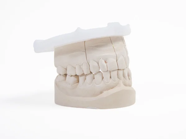 Copia de prótesis dentales — Foto de Stock