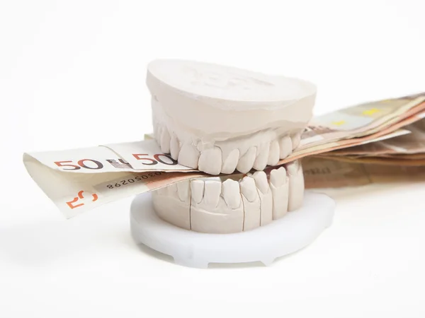 Prothèses dentaires coûtent beaucoup d'argent — Photo
