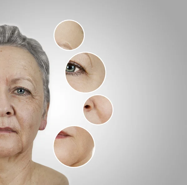 Wrinkle smoothing old — Stock Photo, Image