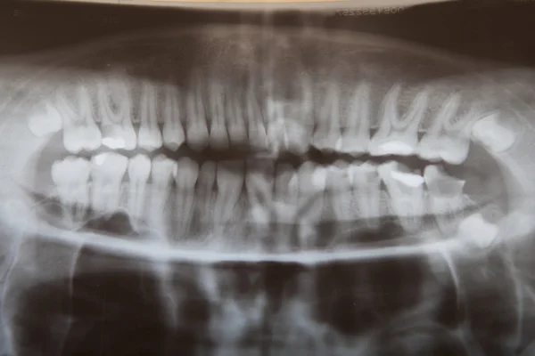 Dents de radiographie dentiste — Photo