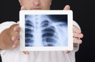 X-ray on the digital tablet clipart