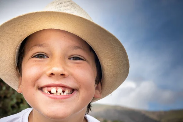 Close Van Jongen Tonen Ontbrekende Tanden — Stockfoto