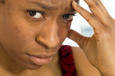 Model acı baş ağrısı