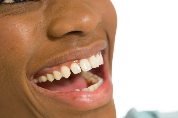Sorriso dentato di donna — Foto Stock