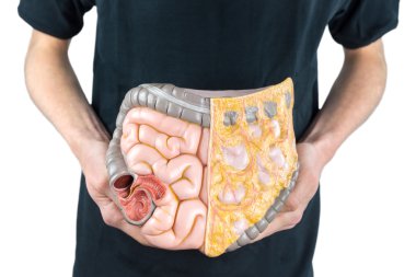 Man holding model of human intestines or bowels on white clipart