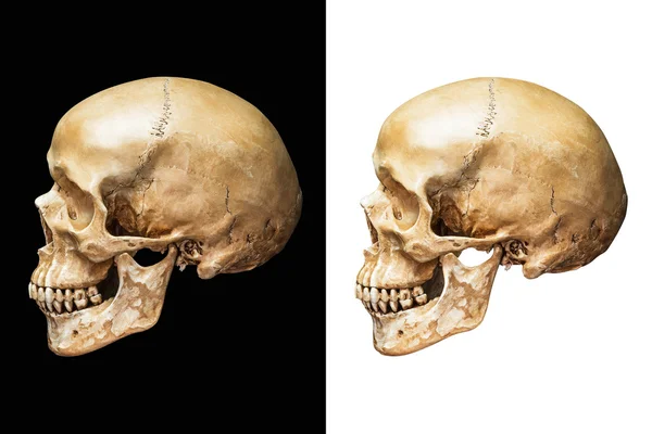 Craniul uman izolat — Fotografie, imagine de stoc