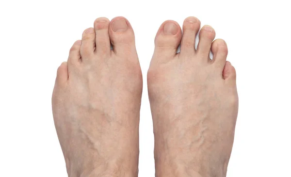 Αρσενικά Πόδια Απομονωμένα Λευκό Φόντο Μονοπάτι Απόληξης — Φωτογραφία Αρχείου
