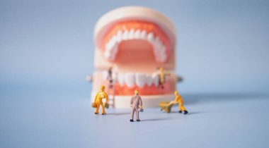 Minyatür işçiler mavi arka plandaki diş modelini temizleyip düzelttiler. Diş muayenesi kavramı. Düzenli oral sağlık oral sağlık için hayati önem taşır..