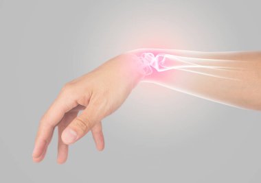 wrist bones injury gray background wrist pain clipart