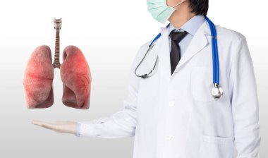 Akciğer zatürresi olan doktorda COVID 19 enfeksiyonu var.