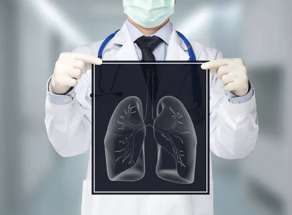 Doctor Sosteniendo Radiografía Pulmonar Para Chequeo Salud —  Fotos de Stock