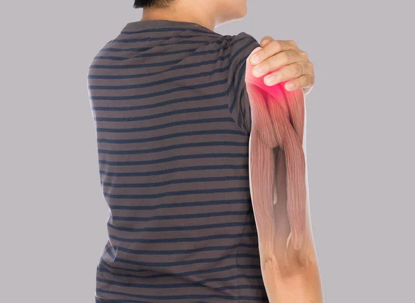 Rayos Dolor Muscular Hombro Lesión Los Músculos Del Brazo Superior —  Fotos de Stock