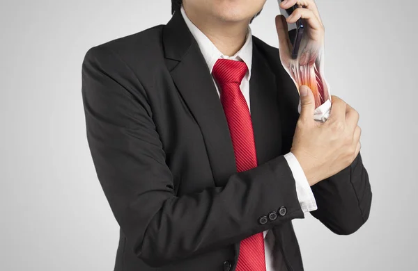 Office Worker Holding Mobile Phone Feels Pain His Wrist Muscle — Stock Photo, Image