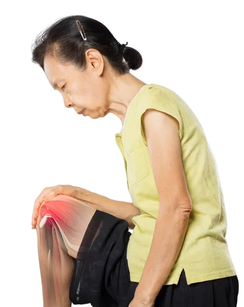 Old Asian Woman Knee Muscle Pain Ray Muscle Injury — Stock Photo, Image