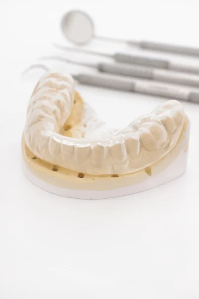 Fusioni ortodontiche — Foto Stock