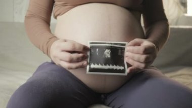 pregnant tummy and female hands holding sonogram image of healthy unborn baby