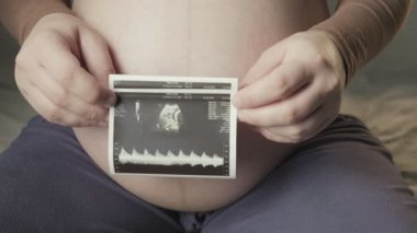 pregnant tummy and female hands holding sonogram image of healthy unborn baby