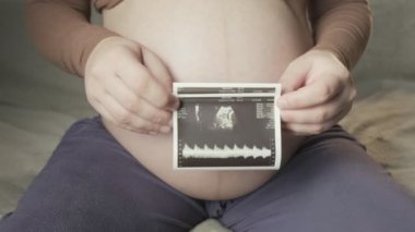 pregnant tummy and female hands holding sonogram image of healthy unborn baby