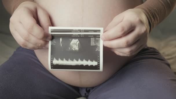 Pregnant tummy and female hands holding sonogram image of healthy unborn baby — Vídeo de stock