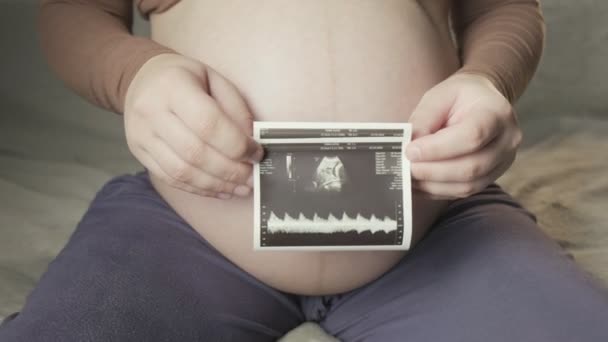 Pregnant tummy and female hands holding sonogram image of healthy unborn baby — Vídeo de stock