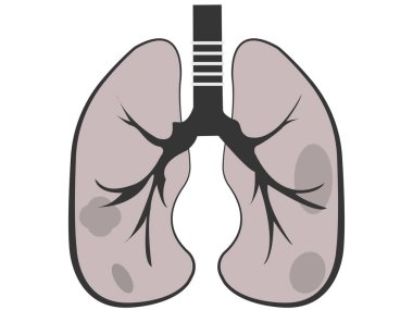 Kanser ya da amfizem gibi bir hastalığın akciğerlerini çiziyor.