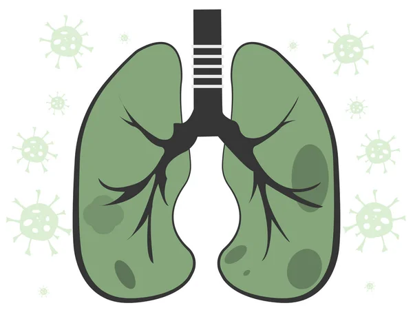 Coronavirus Vírussal Fertőzött Beteg Tüdők — Stock Vector