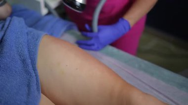 Estetisyen eldiven eldiveni ve el kameralı ultrasonik cihazla, havluyla sarılı hasta bacağı ve cilt ısıtmasına yakın mesafeden radyasyon tedavisi uygular.