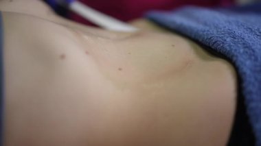 Beyaz kadın göğsü kaplıcada ağda yapıyor, eldivenli estetisyen sıcak balmumunu göğüs kafesine yayıyor havlunun üzerine spatula sürüyor, gövdeye yakın çekim pürüzsüz bir cilt, yumuşak bir cilt gösteriyor