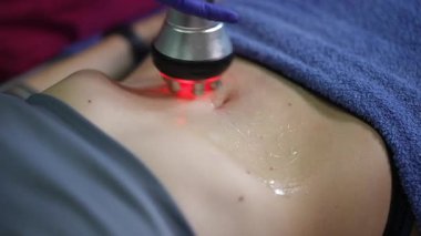 Karnı kapalı kırmızı ışık terapisi, beyaz kadının mor eldivenli klinisyen olduğunu gösteriyor. El bilgisayarı jöleli cilt üzerinde, mavi havluda, odaklanmış, zararsız.