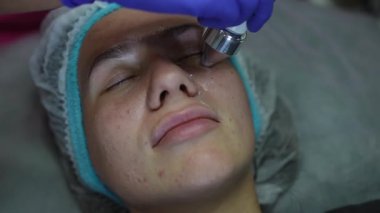 Rf kaldırma işlemi sırasında genç bir kadının yüzüne yakın çekim. Güzellik uzmanı cerrahi olmayan bir yüz gerdirme için profesyonel bir cihaz kullanıyor.