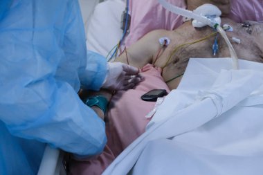 Yunanistan 'da 5 Kasım 2020' de Atina Hastanesi 'nde Coronavirus hastalığı (COVID-19) geçiren hastalar için yoğun bakım ünitesinde koruyucu giysi ve maskeli doktorlar.