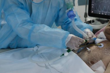 Yunanistan 'da 5 Kasım 2020' de Atina Hastanesi 'nde Coronavirus hastalığı (COVID-19) geçiren hastalar için yoğun bakım ünitesinde koruyucu giysi ve maskeli doktorlar.