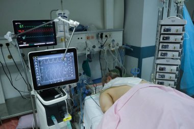 Yunanistan 'da 5 Kasım 2020' de Atina Hastanesi 'nde Coronavirus hastalığı (COVID-19) geçiren hastalar için yoğun bakım ünitesinde koruyucu giysi ve maskeli doktorlar.