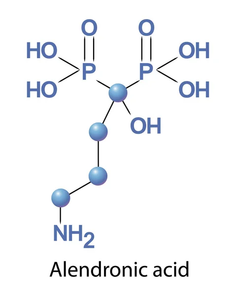 Médicament à base d'acide alendronique utilisé pour traiter l'ostéoporose et la maladie de Pagets — Image vectorielle