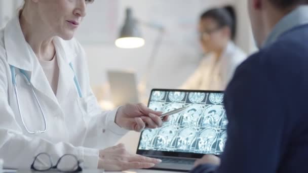 Incline Tiro Meia Idade Médico Zoom Imagem Raio Cérebro Tela — Vídeo de Stock