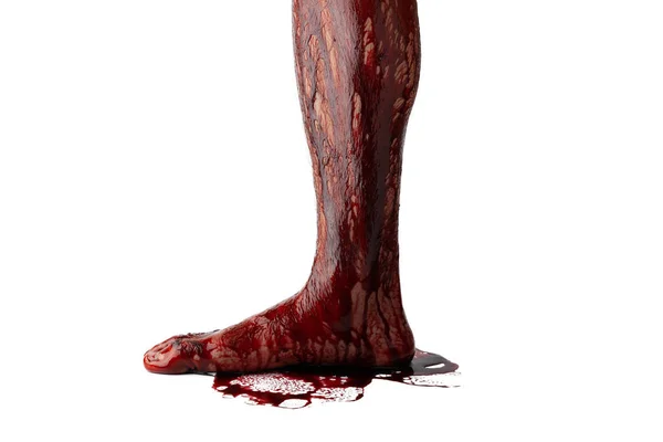 Αιμορραγία Ανθρώπινο Πόδι Απομονώνονται Λευκό Φόντο — Φωτογραφία Αρχείου