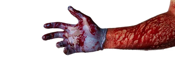 Mano Ensangrentada Guantes Médicos Aislados Sobre Fondo Blanco — Foto de Stock