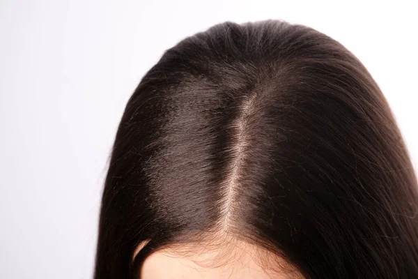 Gros Plan Sur Les Racines Féminines Des Cheveux Séparation Vue Images De Stock Libres De Droits