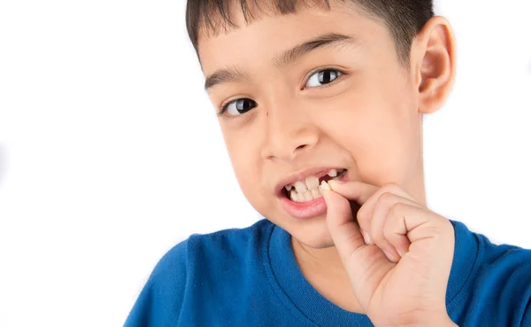 Menino mostrando dentes de bebê sem dentes perto esperando por novos dentes — Fotografia de Stock