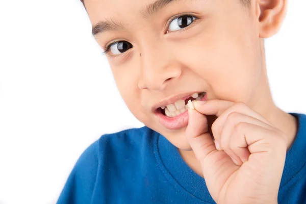 Menino mostrando dentes de bebê sem dentes perto esperando por novos dentes — Fotografia de Stock